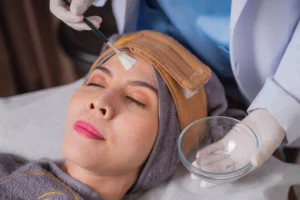 6. Acne Repair Peeling