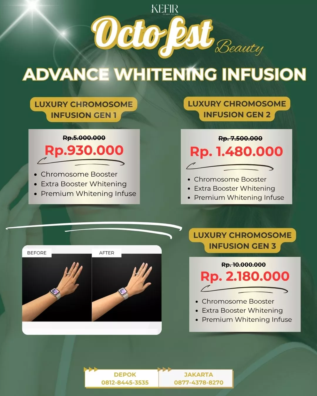 advance infus whitening KDC Oktober 2025