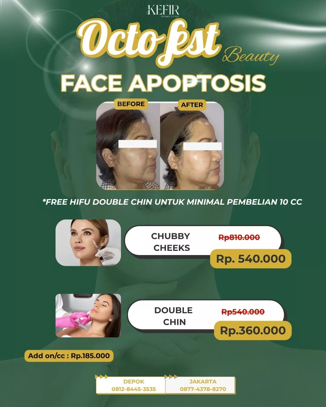 face fat apoptosis KDC Oktober 2025