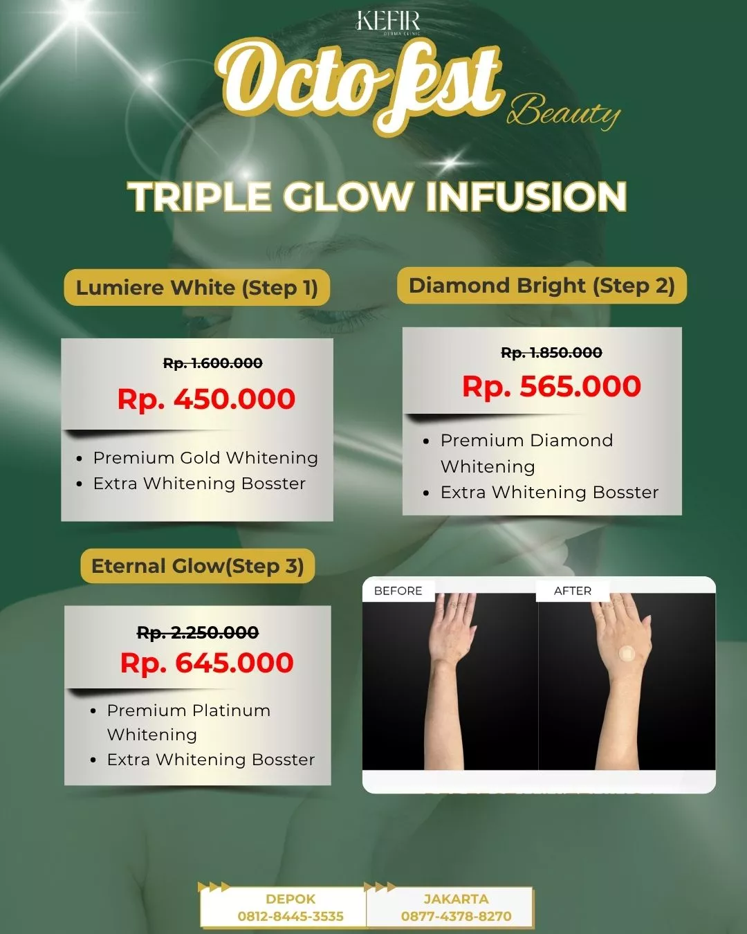 infus whitening KDC Oktober 2025